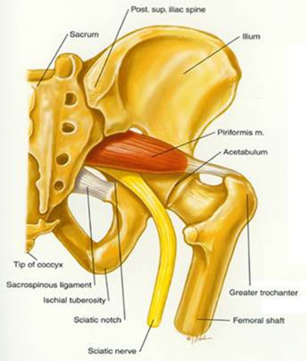 <p>greater trochanter of femur</p>
