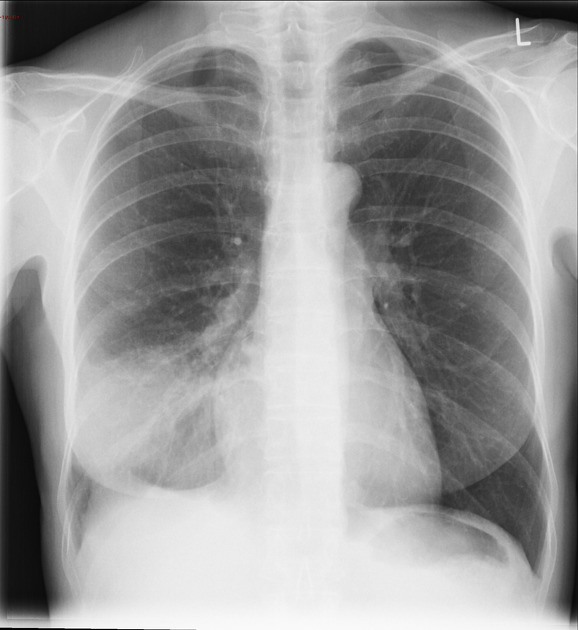 <p>Describe the abnormality demonstrated.</p>