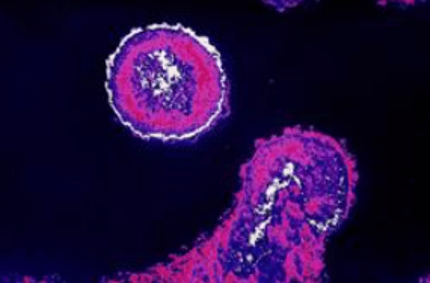 <p>An STD, or ______, is an illness that is passed from one person to another through sexual activity.</p>