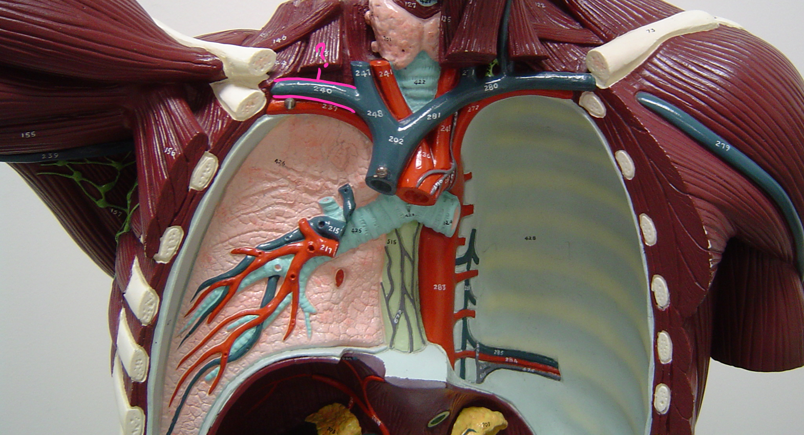 <p>what blood vessel is this? (in pink)</p>