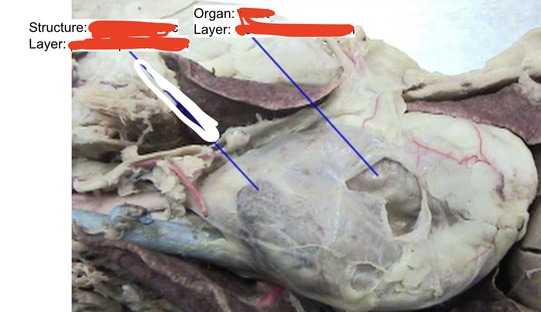 <p><em>blue line organ</em></p>