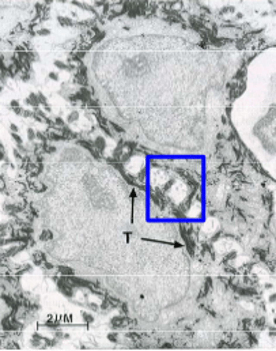 <p>What structures do keratin filaments form in epithelial cells?</p>