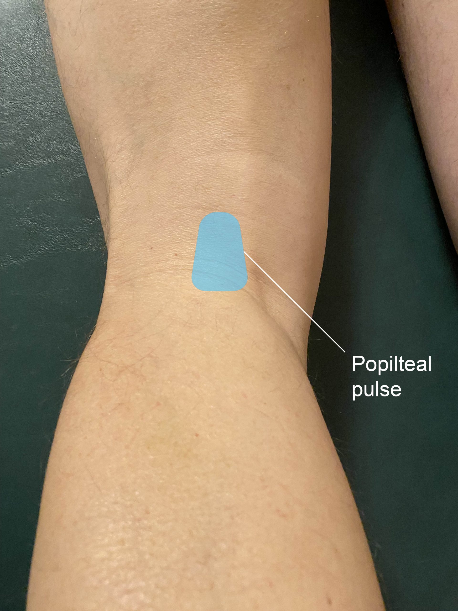 <p>behind the knee</p>