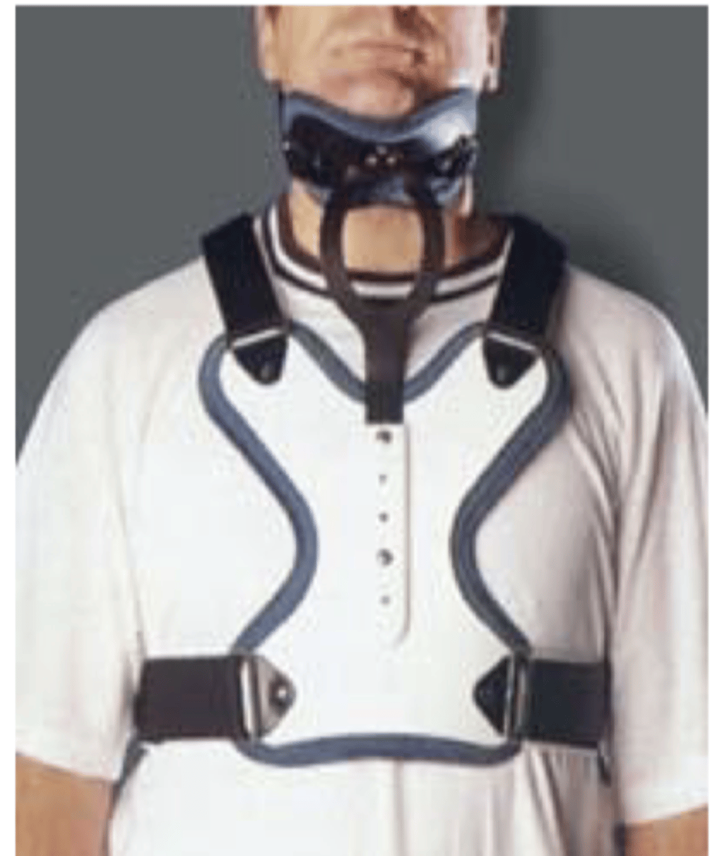 <p>immobilization cervical - minerva body jacket:</p><p>- thermoplastic encases chin and ___ aspect of skull</p><p>- extends down to ___</p><p>- headband around skull</p><p>- restricts cervical motion in all ___</p>