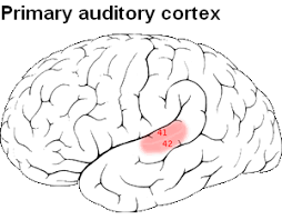 <p><span><strong>Overview:</strong>processes sensory information in the form of sound(not directly or completely responsible for the hearing, essential to processing)</span></p><p><span><strong>Damage Symptoms:</strong>may be able to collect sound stimuli but if a person doesn't have the ability to process sounds,the noise seems to be jumbled and meaningless. some are completely unaware of sound, they still react reflexively to loud or sudden sounds as there auditory processing that occurs below the cortex.</span></p>