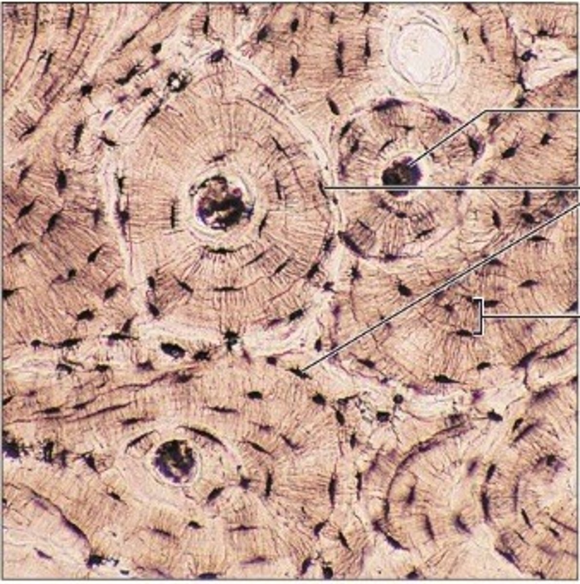 <p>matrix = rigid (calcified)</p><p>- hardest CT</p><p>FUNCTION</p><p>- protects internal organs</p><p>- supports body</p><p>MATRIX</p><p>- collagen fibers covered in mineralized ground substance (HYDROXYAPATITE)</p><p>FUNCTION</p><p>- collagen helps to make bone more flexible and less brittle</p><p>- mineral crystals help increase bone rigidity and support</p><p>- osteocytes (bone cells) in the lacunae</p><p>- HEALS QUICKLY</p>