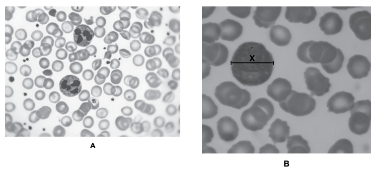 <p>A because nuclei (of white blood cells) are lobed ✓</p>