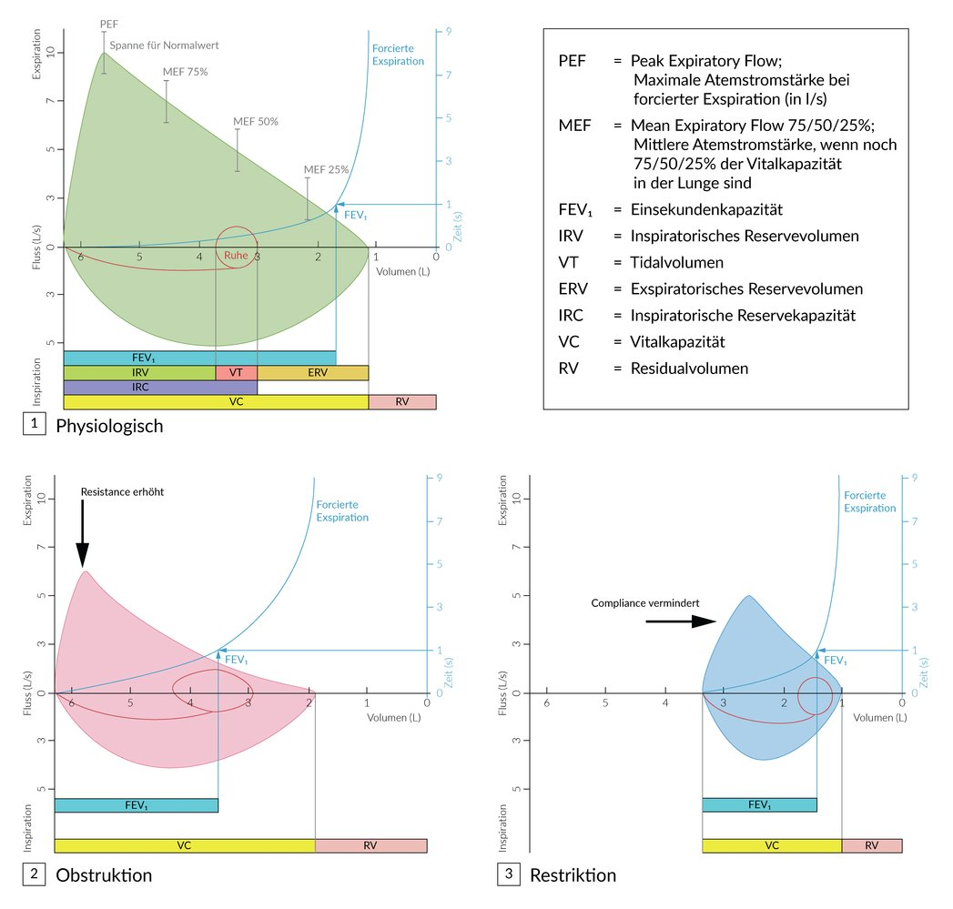 <p>C. An obstructive ventilation disorder is characterized by increased airflow resistance in the airways.</p>