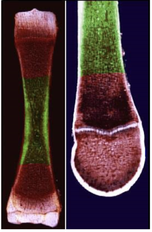 <p>What area in bone is this called?</p>