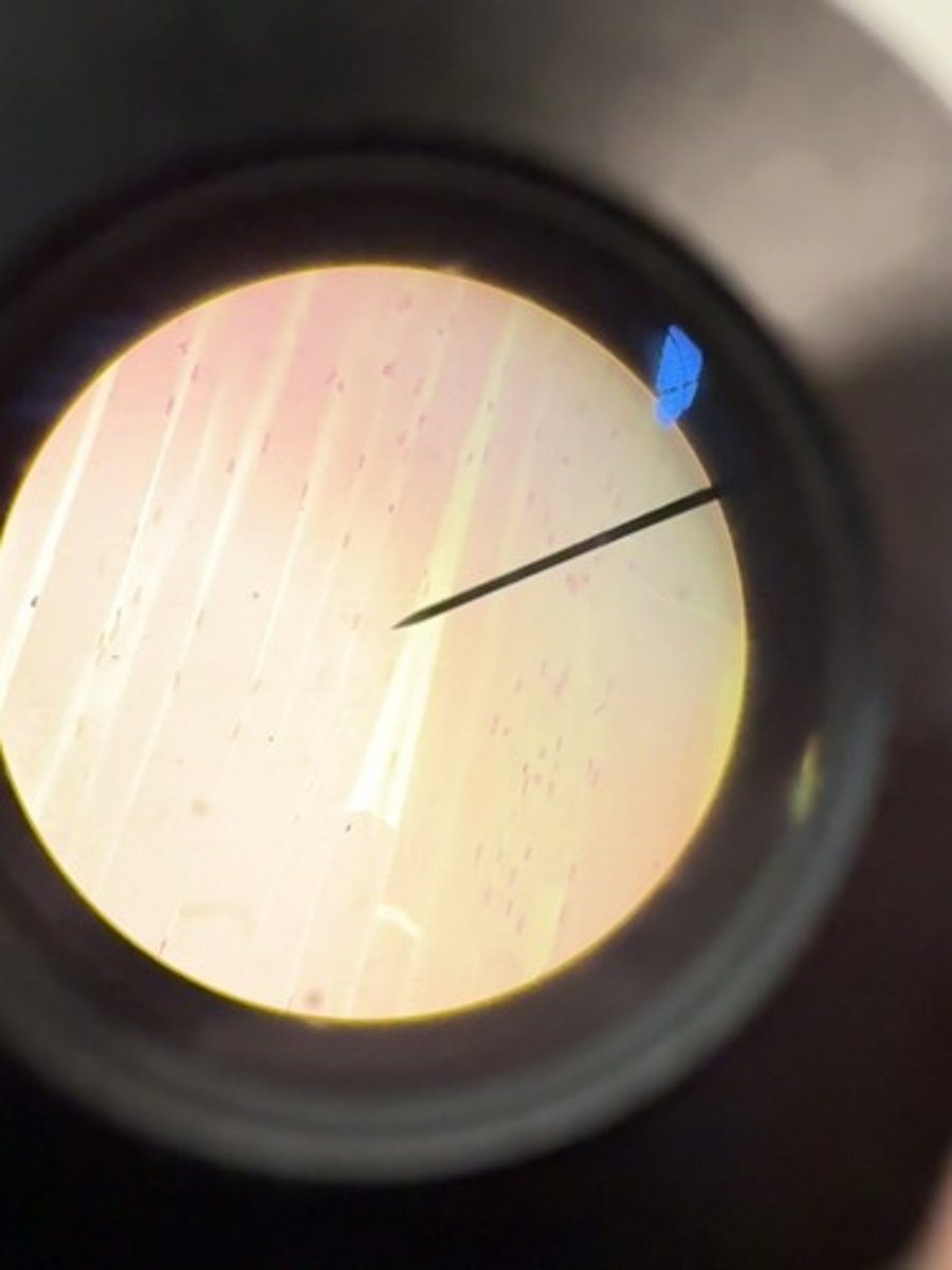 <p>Skeletal muscle</p>