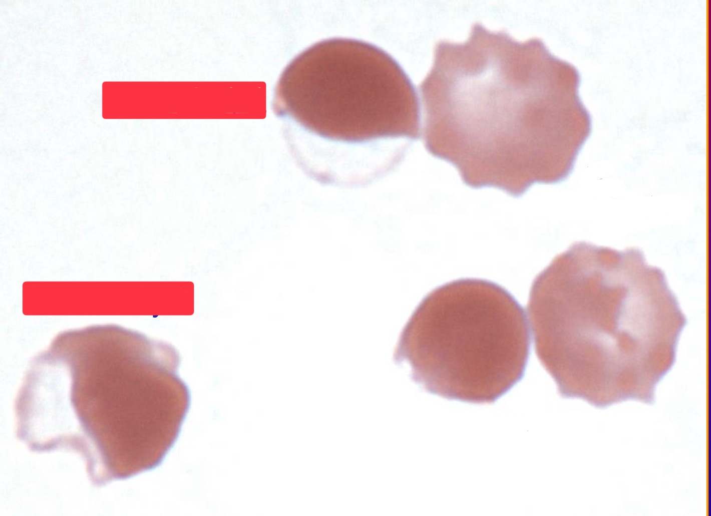 <p>What are these cells?</p>