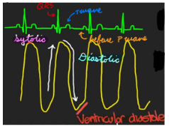 <p>Right Ventricle Pressure</p>