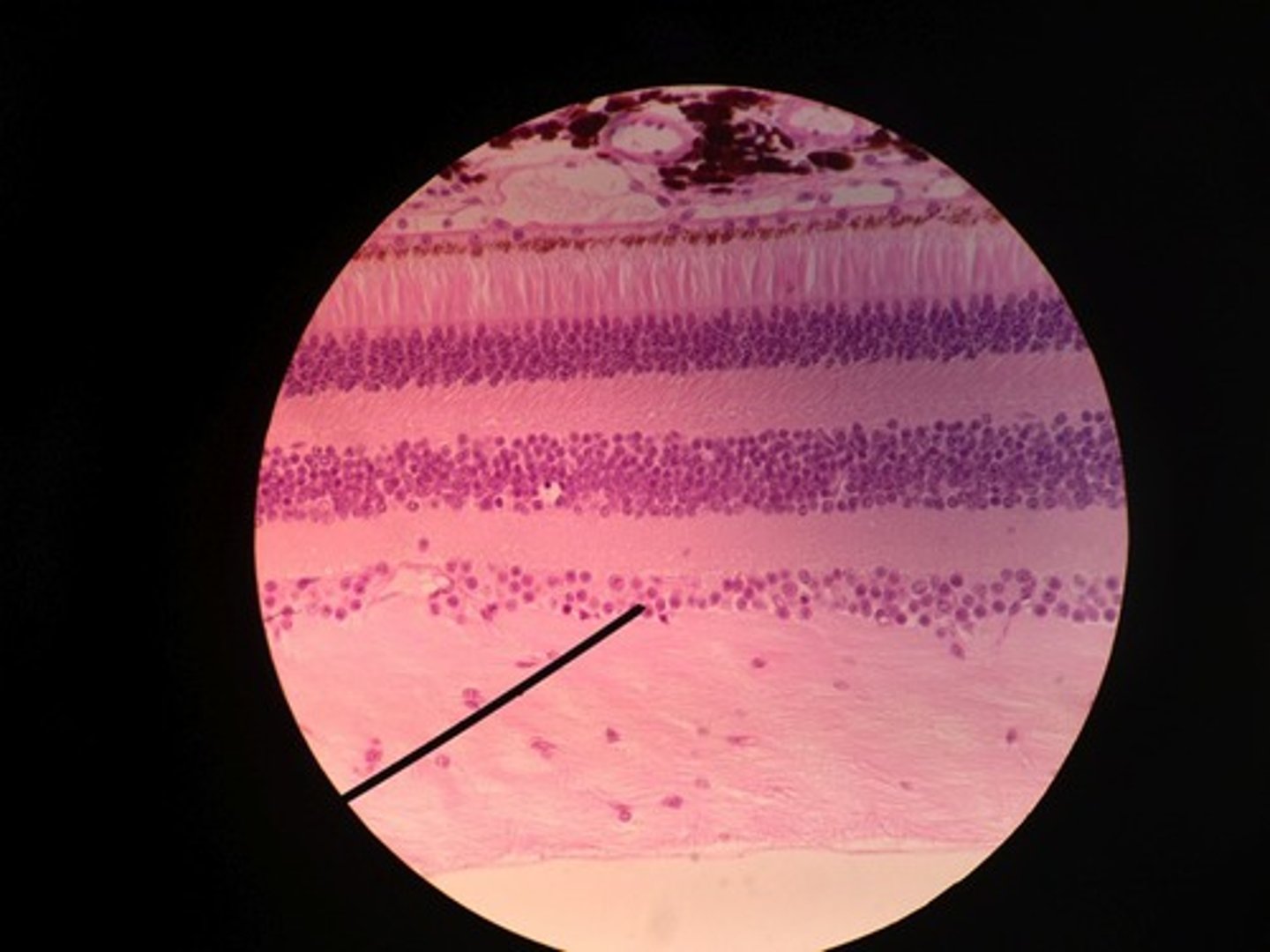 <p>A layer of the retina closest to the center of the eye, containing ganglion cells</p>