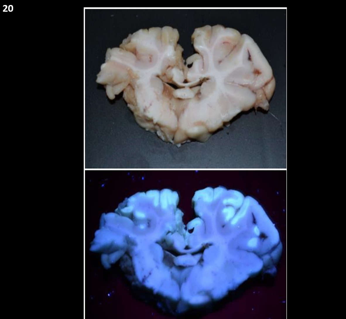 <p>20.<span>&nbsp; </span>Tissue from an ox. <span>&nbsp;</span>Which of the following is NOT a potential cause for this lesion?</p><ol type="a"><li><p>Water deprivation</p></li><li><p>Bracken fern ingestion</p></li><li><p>Cobalt toxicity</p></li><li><p>Lead toxicity</p></li></ol><p></p>