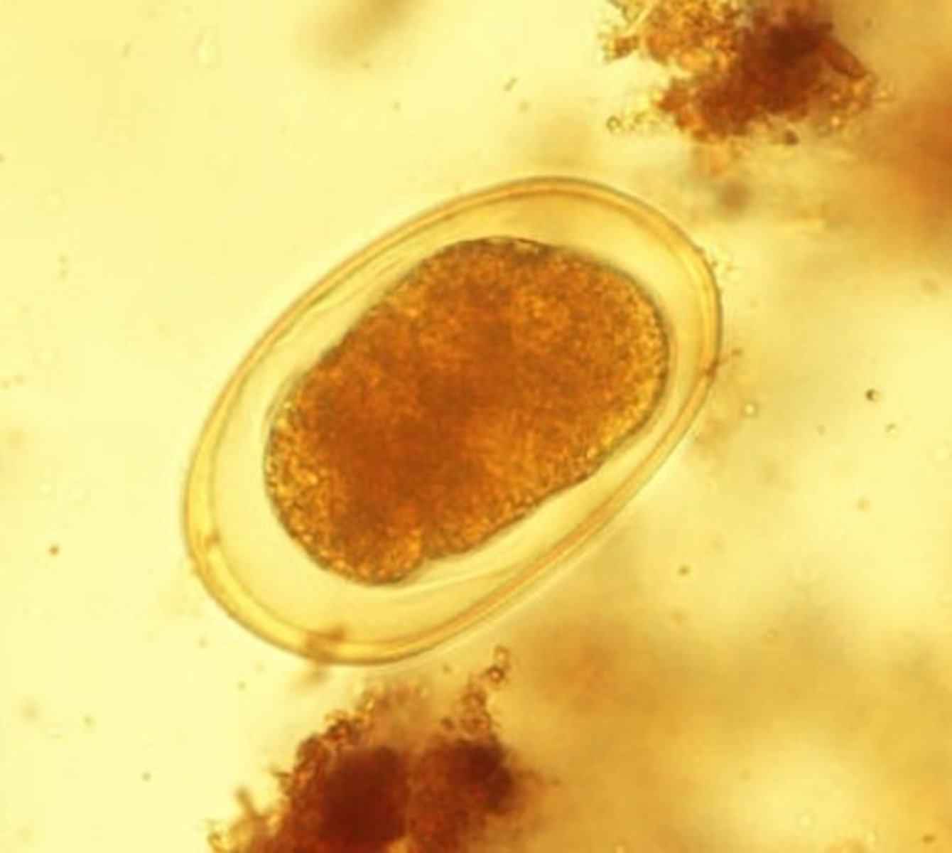 <p>Identify the parasite</p>