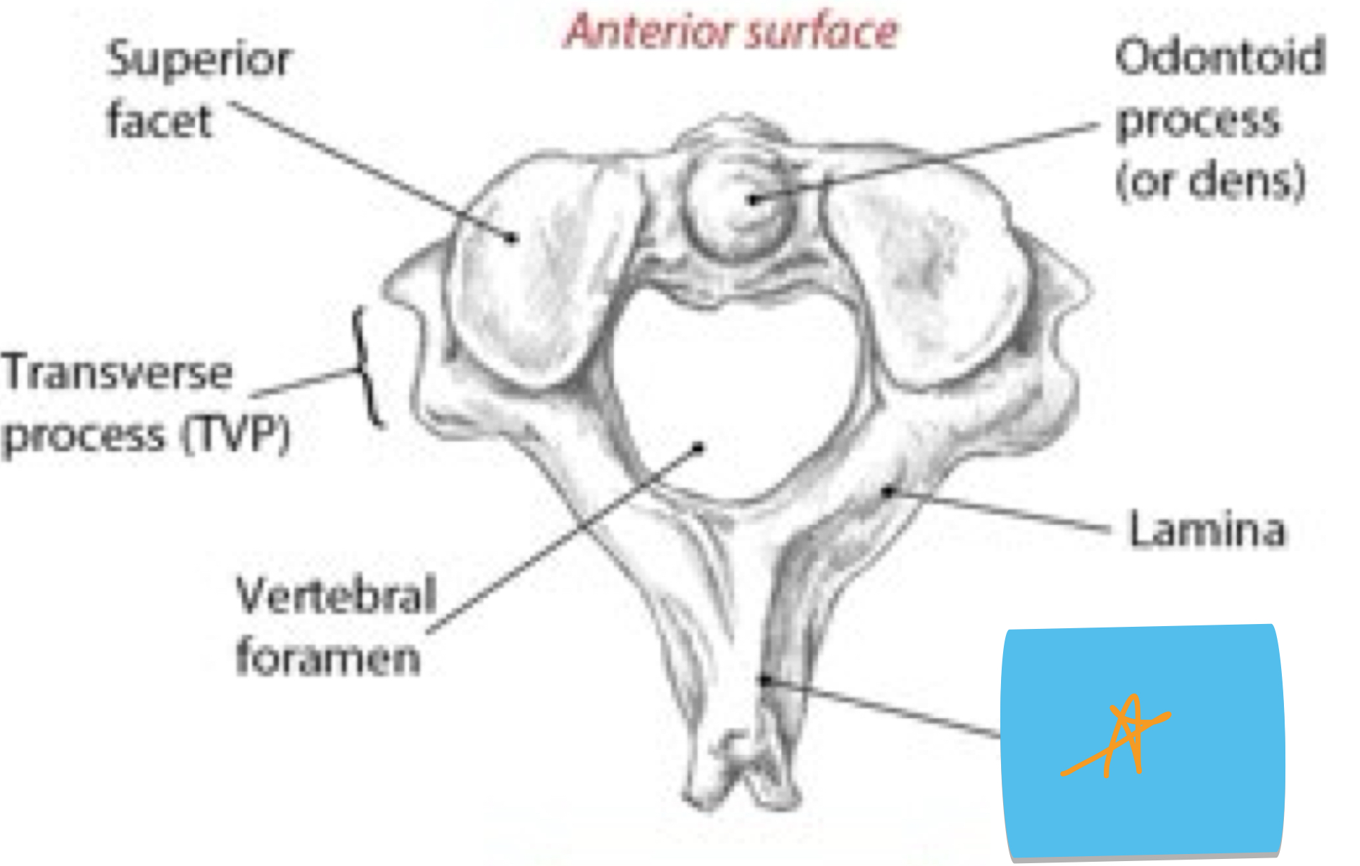 <p>Identify this structure and anatomical significance (black star)</p>