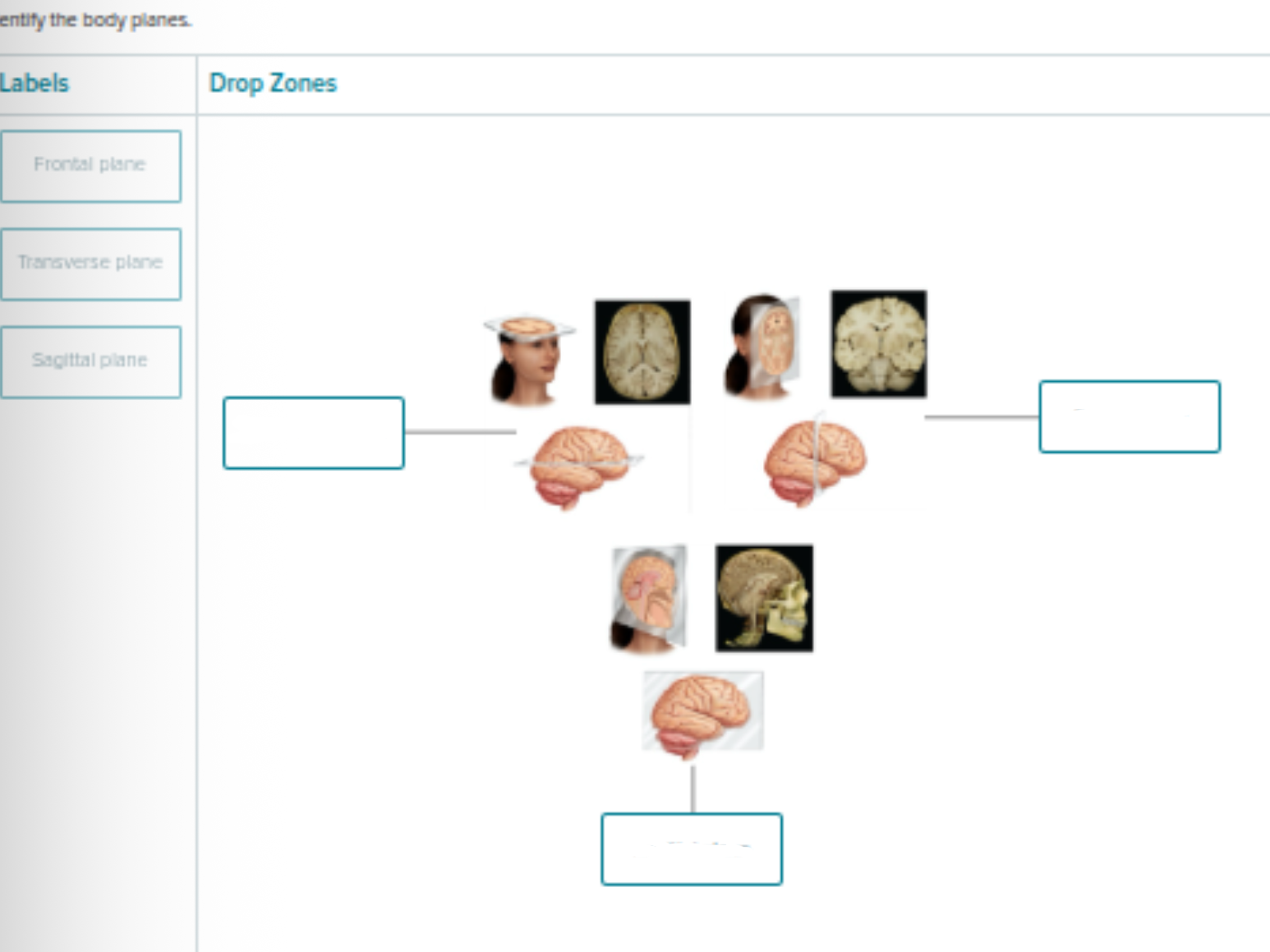 <p>Identify the body planes</p>