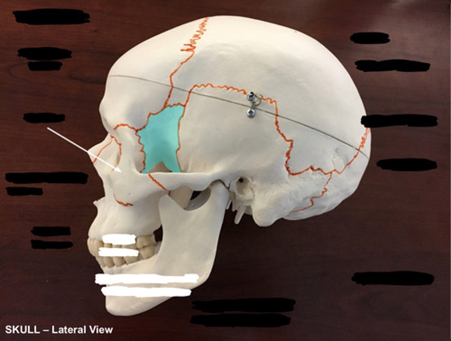 <p>What bone is highlighted here?</p>