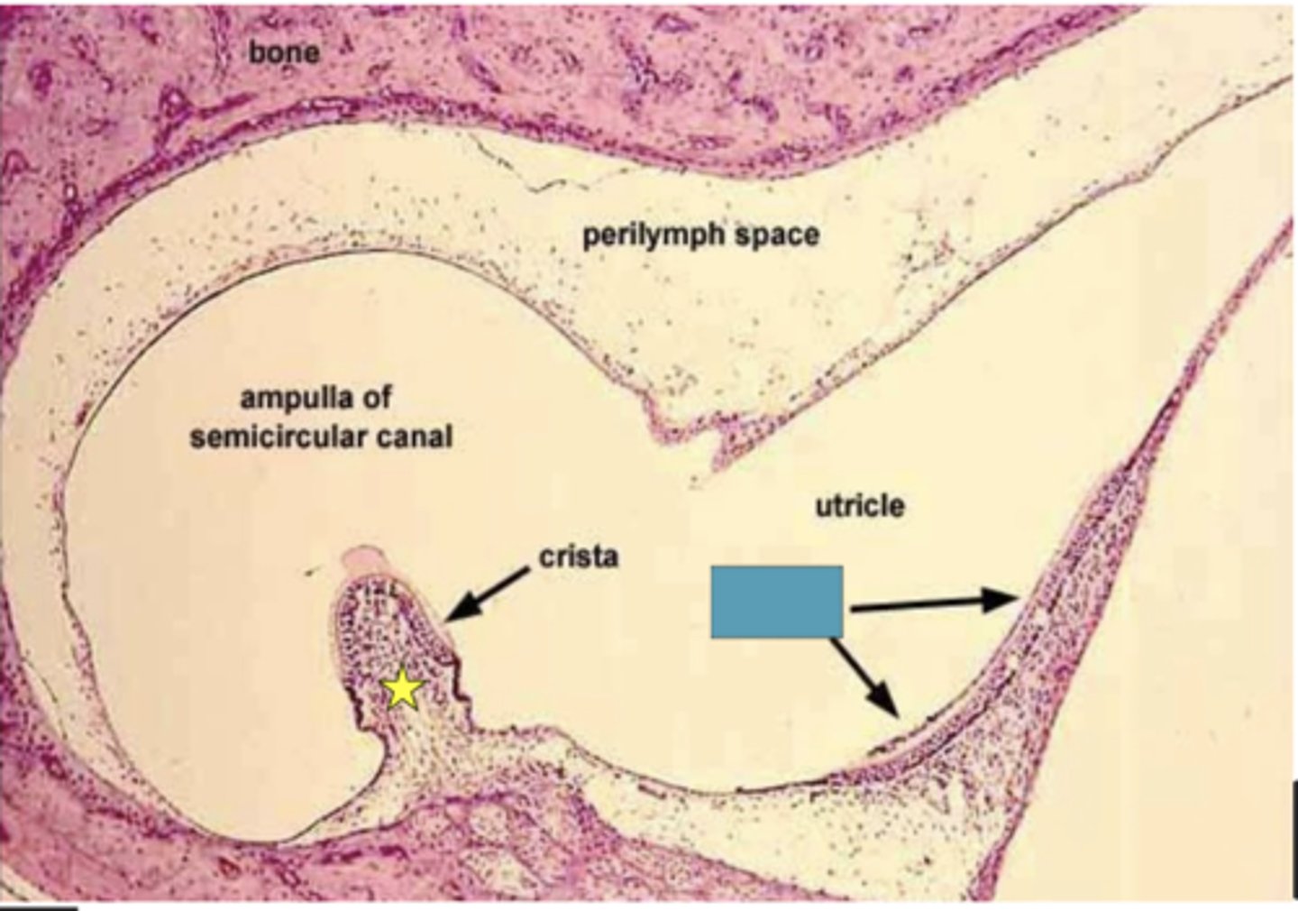 <p>Identify the following structure</p>