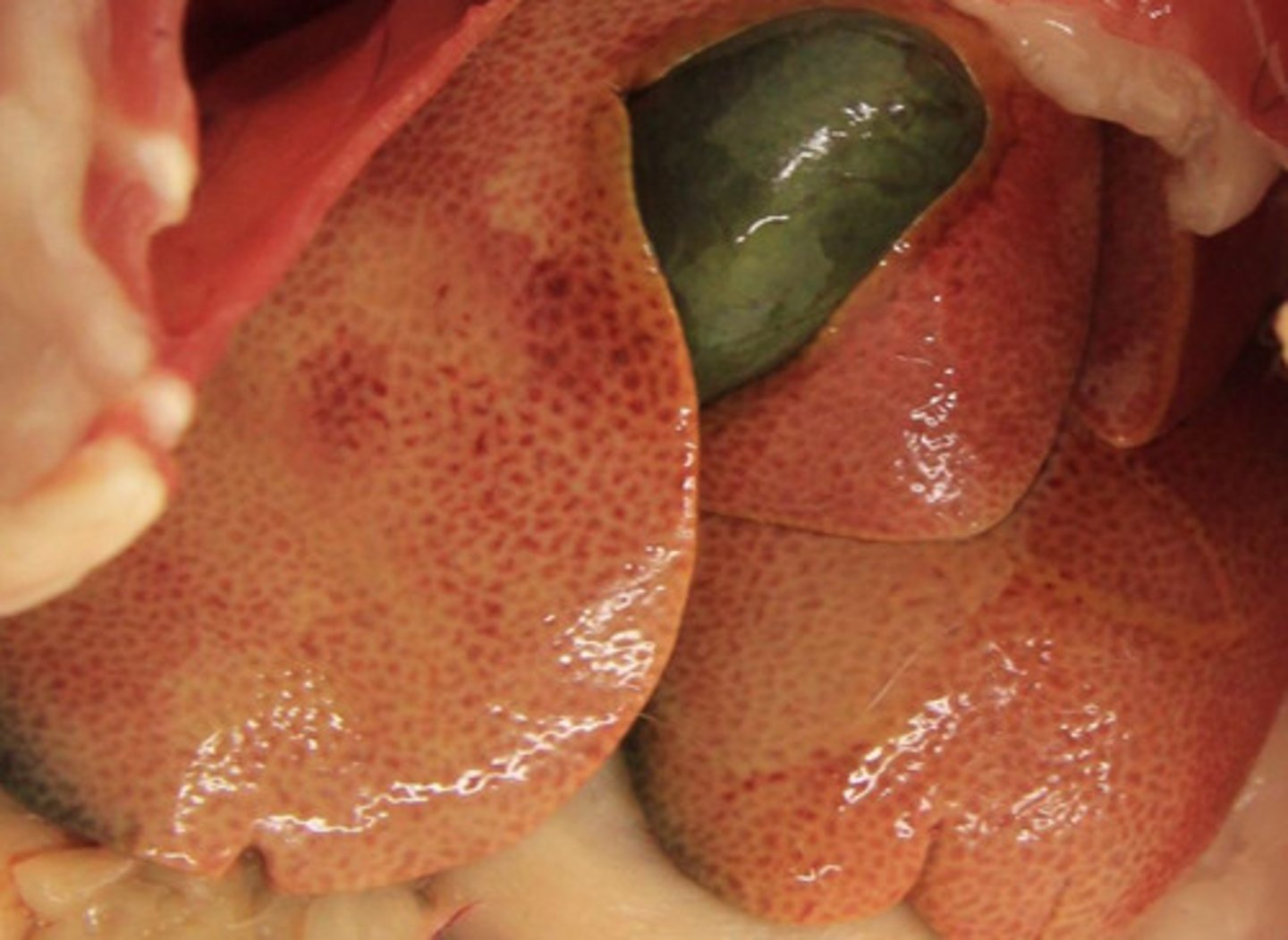 <p>Identify the pathology?</p>