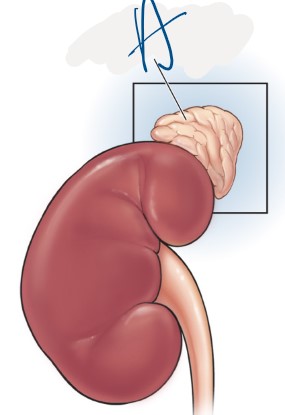 <p>What structure is indicated by A</p>