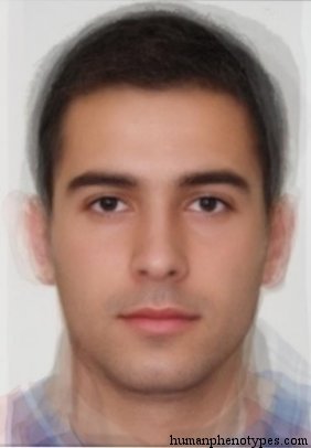 <p>Identify this Phenotype</p>