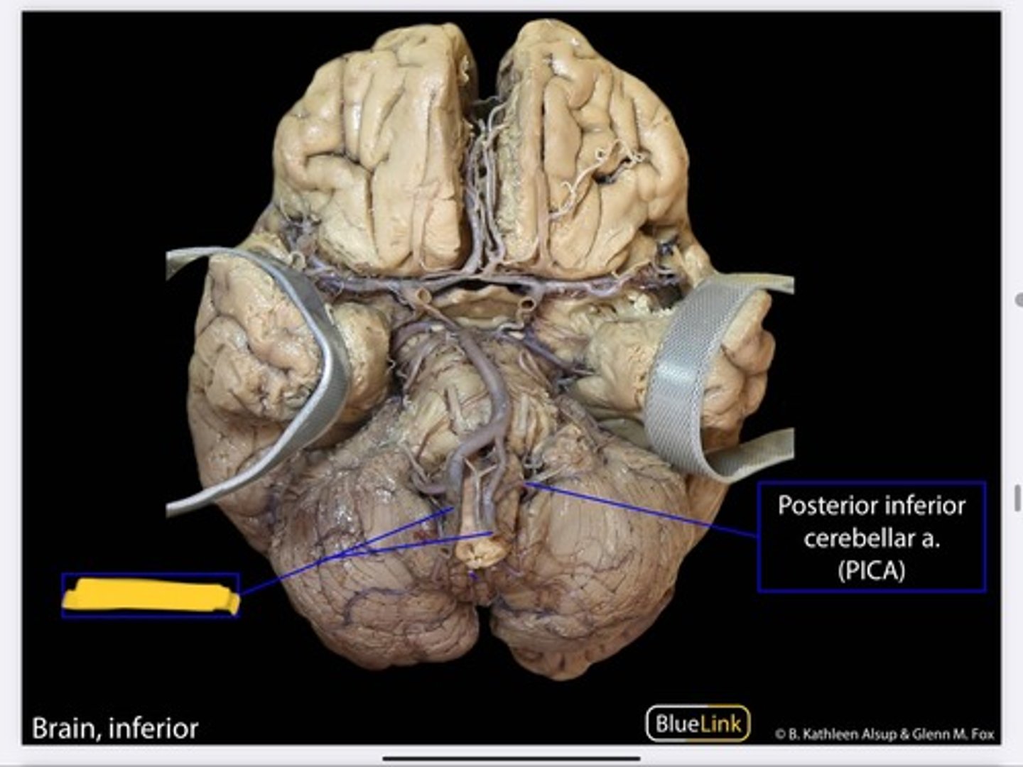 knowt flashcard image