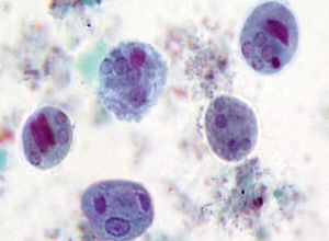Cyst E. histolytica