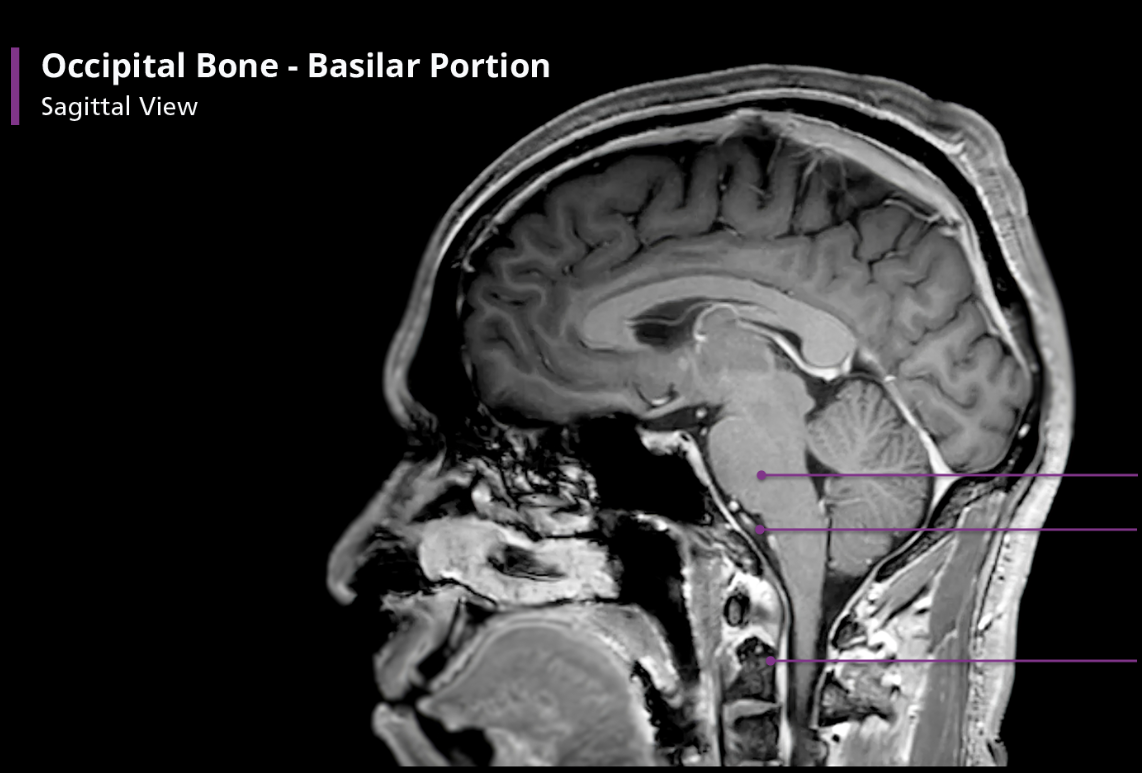 <p>Occipital Bone - Basilar portion</p>