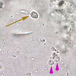 <p>Cryptosporidium parvum</p><p>Cyst= 4-6 um</p><p>Troph= 2-3 um</p>