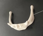 <p>an attachment point for tendons and ligaments of the neck</p>