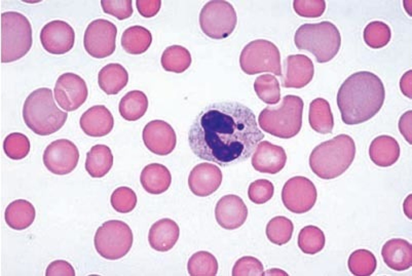 <p>Anemia characterized by normal RBCs --> therefore anemia is caused by a low number RBCs</p>