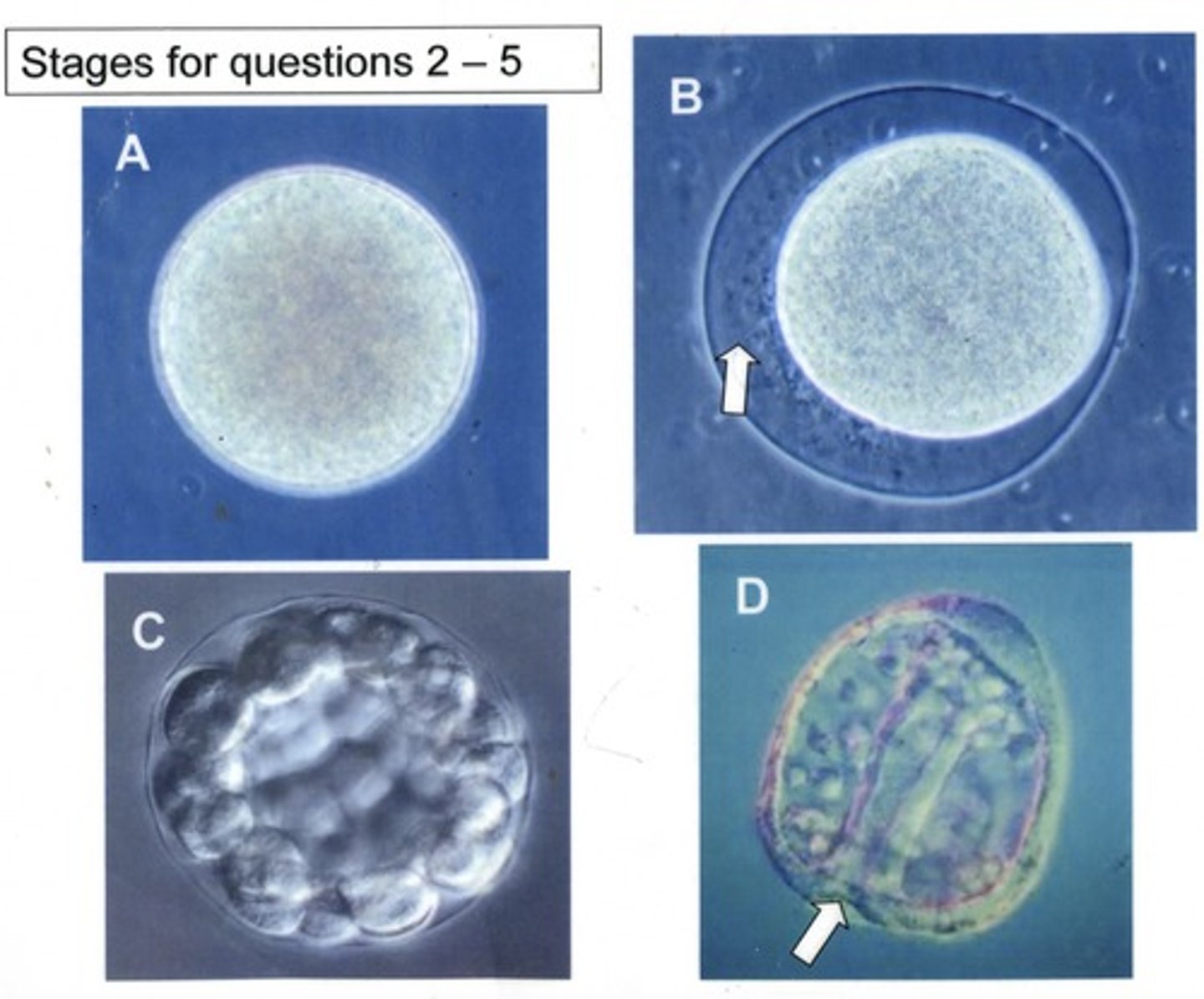 <p>Anus</p>