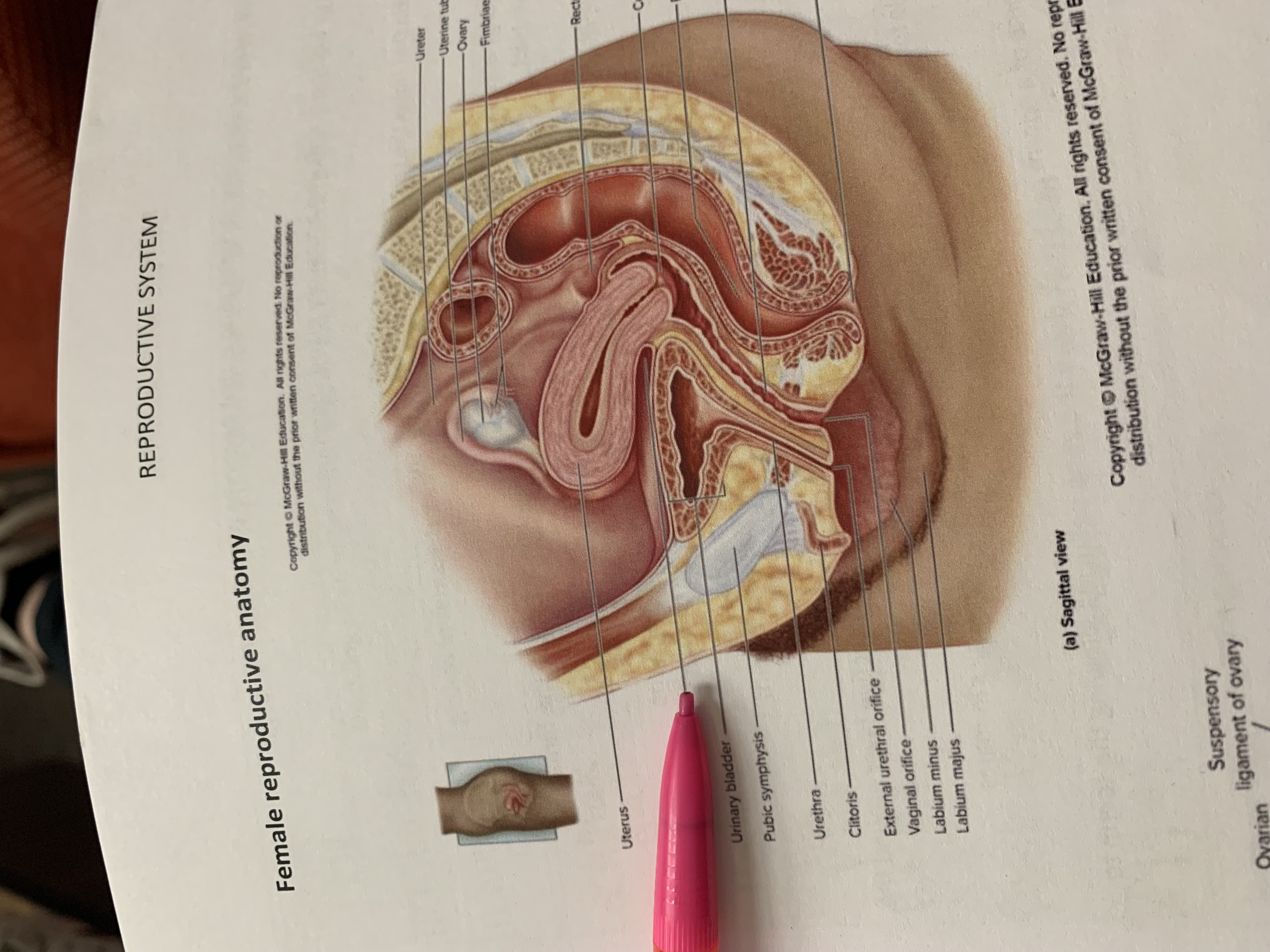 term image