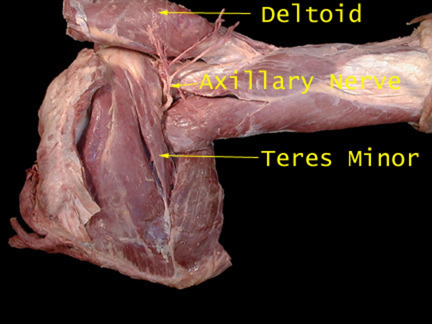 <p>axillary nerve</p>