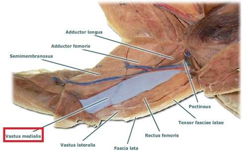 <p>Vastus lateralis m.</p>
