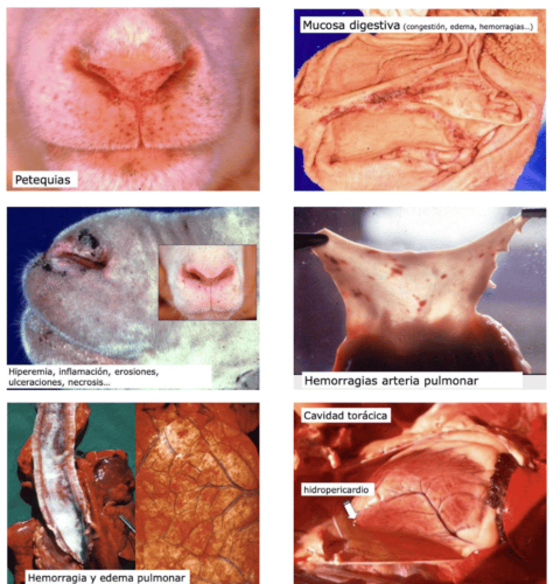 <p>- hemorragias arteria pulmonar + edema pulmonar</p><p>- mucosas GI congestivos, edematosos, hemorrágicos</p><p>- hiperemia, inflam, erosiones, ulceraciones, necrosis</p><p>- hidropericardio</p>