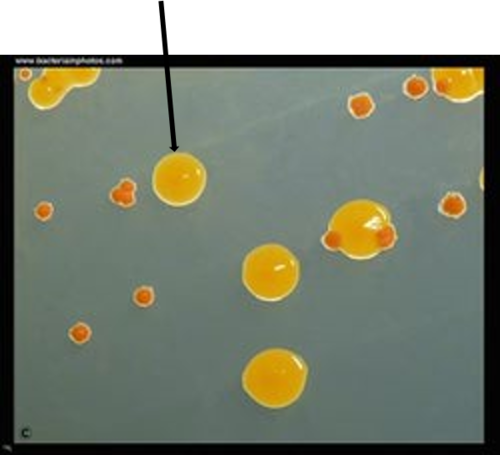 Describe the pigment of this colony