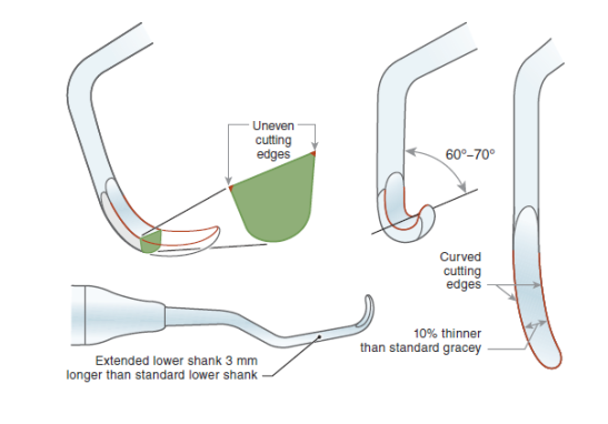 <ul><li><p>Effectiveness of the Gracey decreased with increasing pocket depth</p></li><li><p>Treatment of periodontally involved patients required more specialized instruments to reach into pockets and to work in smaller, tighter spaces because of furcation, and root concavities </p></li></ul><p></p>