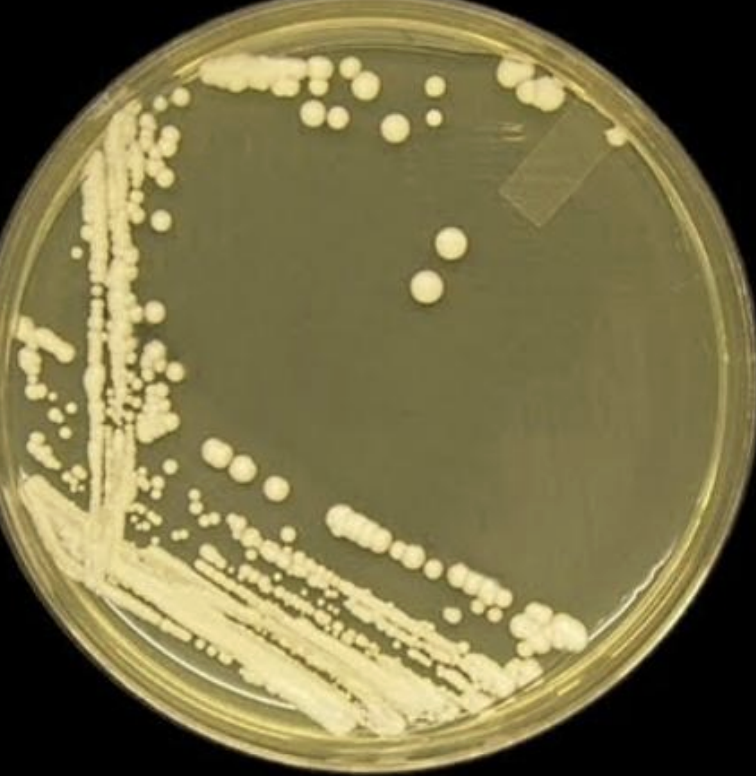 <p>what microbe</p><p>what agar?</p><p>describe?</p>