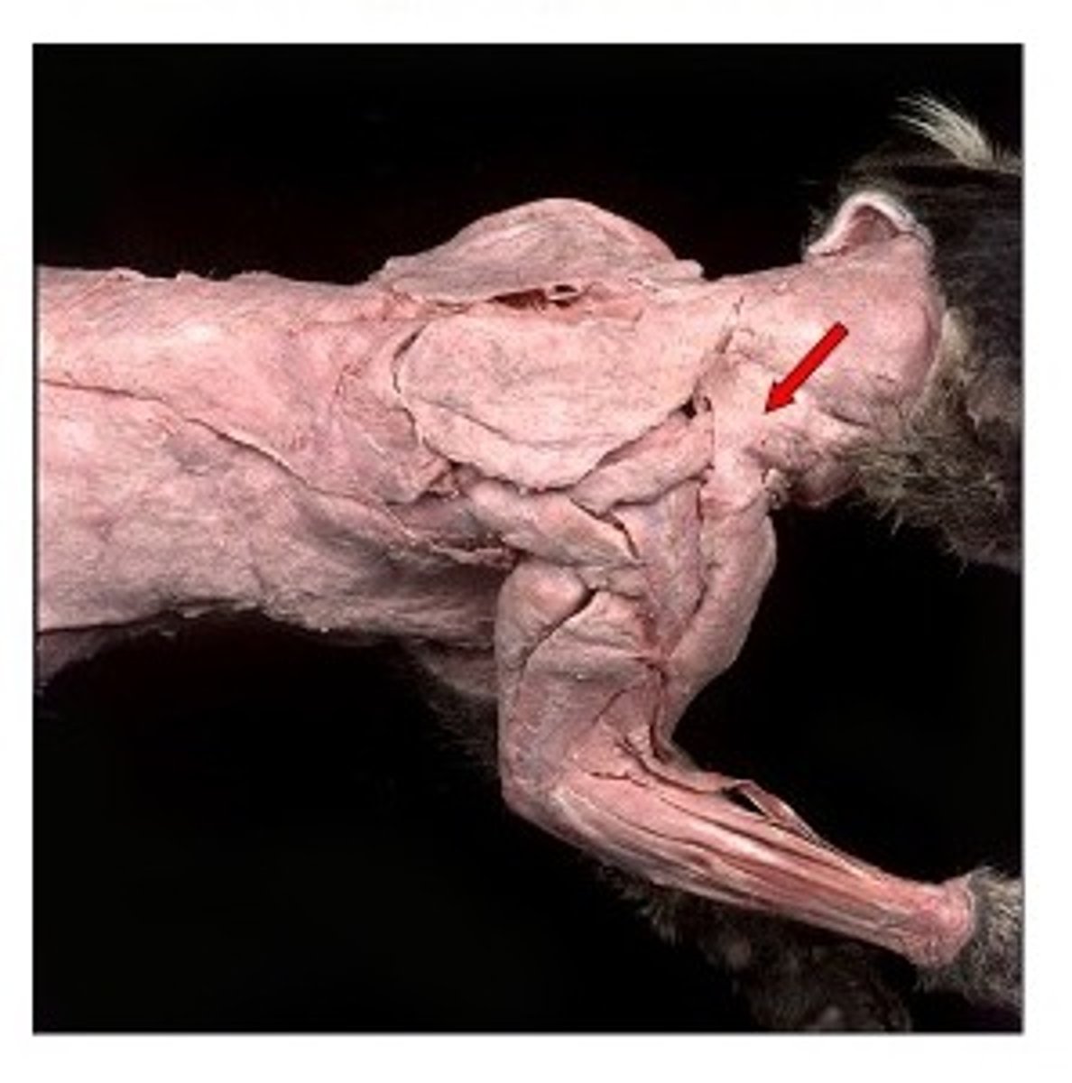<p>What is the muscle? What is an attachment point and function?</p>