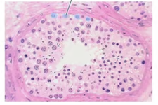 <p><span>Identify the highlighted structures inside the male testis.</span></p>
