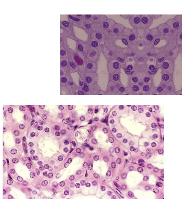 <p>Consists of a single layer of cube-shaped cells</p><p>Cells are arranged like a row of dice</p>