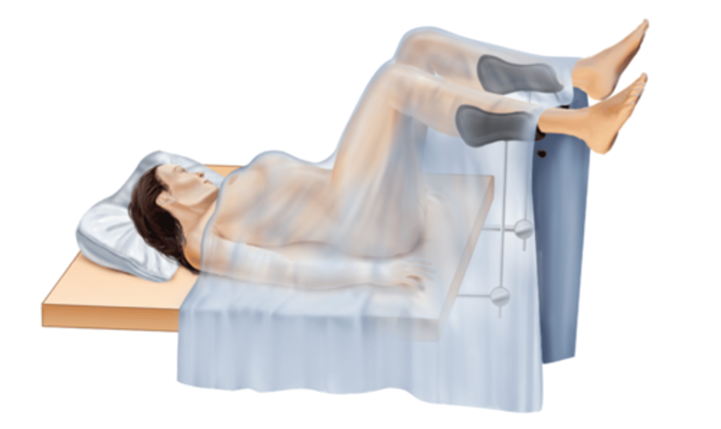 <p>On back with lower extremities flexed and feet placed in stirrups</p>