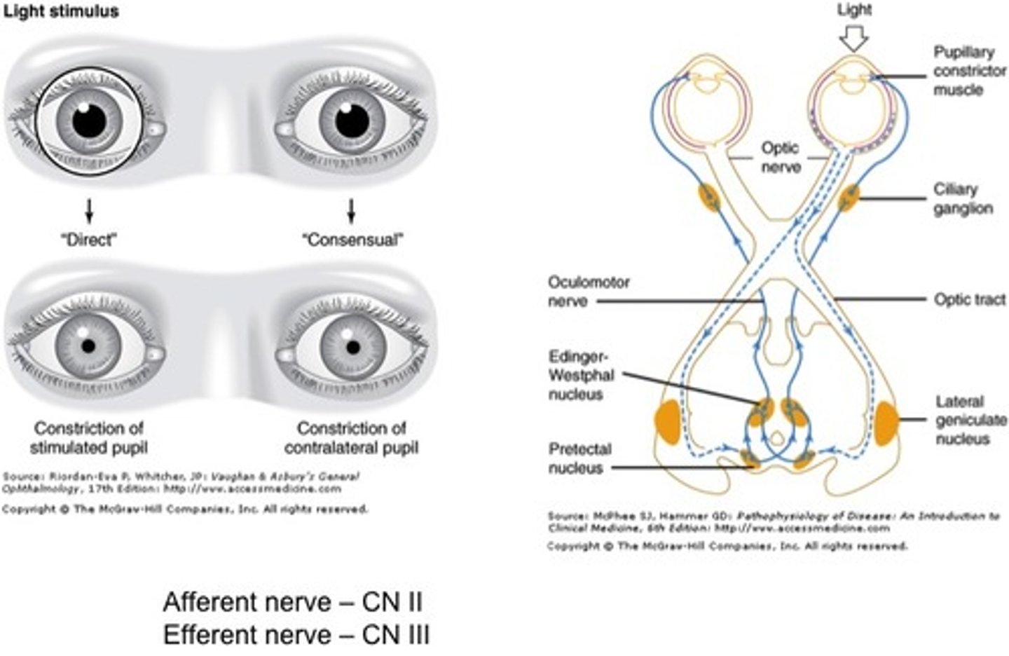 <p>Light stimulation of one eye causes pupil constriction in the contralateral (opposite side) eye.</p>