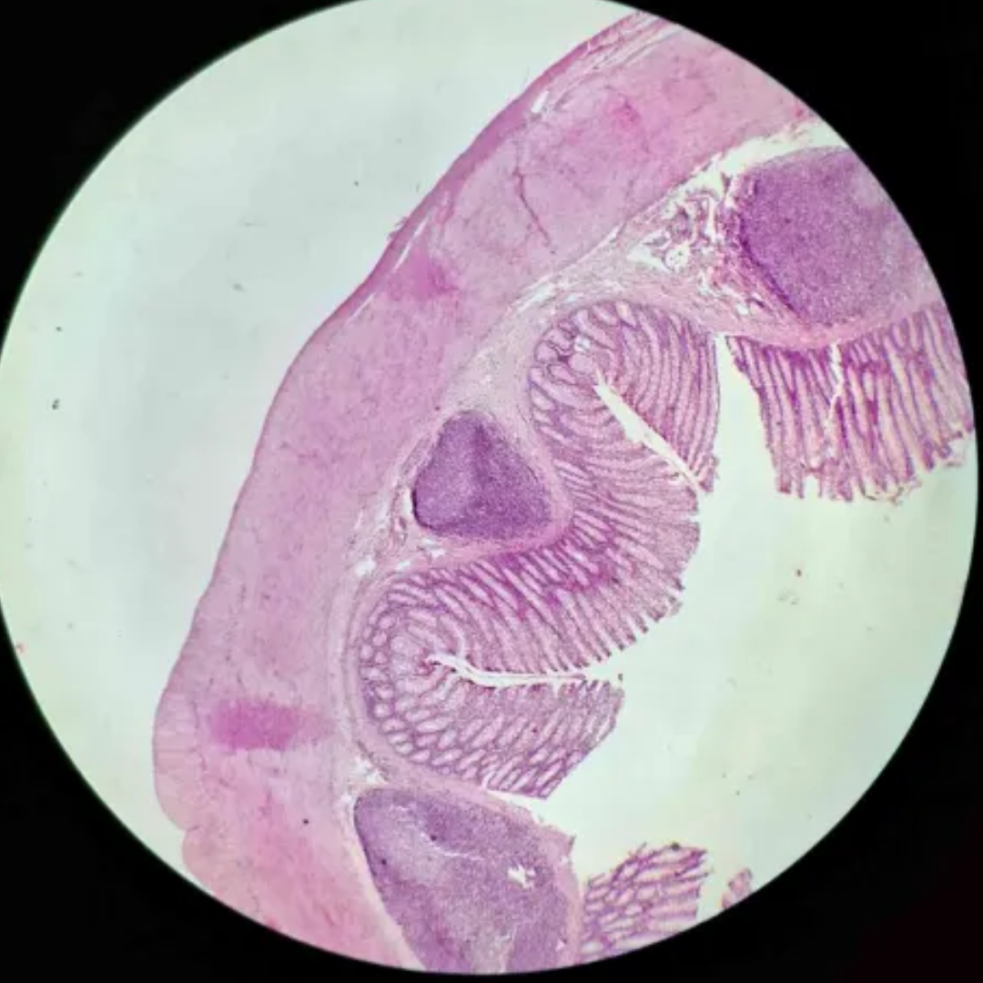 term image