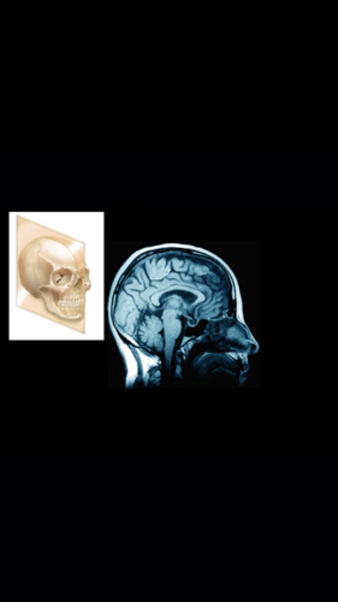 <p>Vertical plane and divides body or organ into equal left and right halves</p>