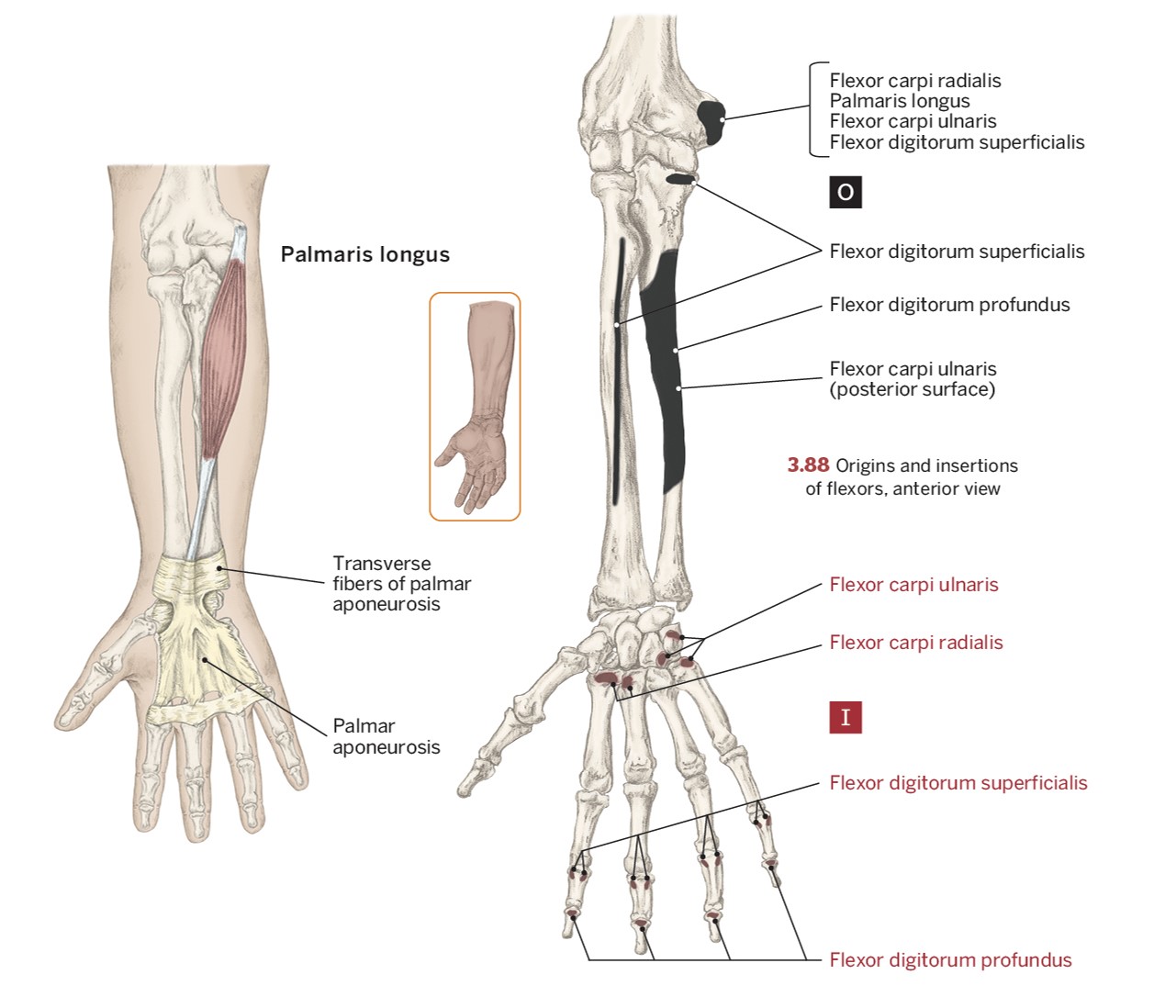 <p>O- Medial Epicondyle of the humerus</p><p>I- Palmar Aponeurosis</p><p>A- Wrist flexion</p>