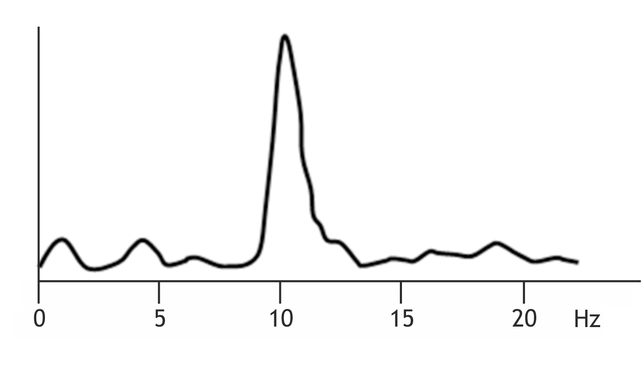 <p>10. The distribution of frequency components (frequency analysis) of the EEG from an occipital lead is shown for a subject in a sleep laboratory.</p><p>Which statement can be derived from the presentation?</p><p>A. The subject is in deep sleep.</p><p>B. The subject is moving their eyes intensely.</p><p>C. The subject is thinking with concentration.</p><p>D. The subject has their eyes open and is observing their surroundings.</p><p>E. The subject has their eyes closed and is mentally relaxed.</p>