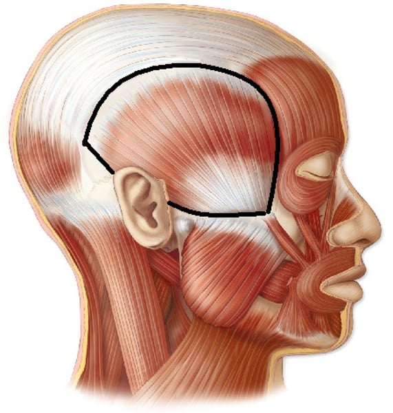 <p>Origin: temporal fossa of cranium<br>Insertion: coronoid process of mandible<br>Action: elevates mandible</p>